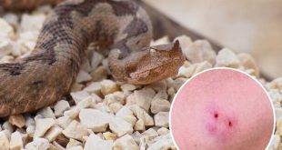 Ugriz zmije u BiH: Kako prepoznati opasnost i pružiti prvu pomoć