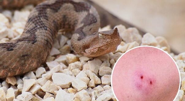 Ugriz zmije u BiH: Kako prepoznati opasnost i pružiti prvu pomoć